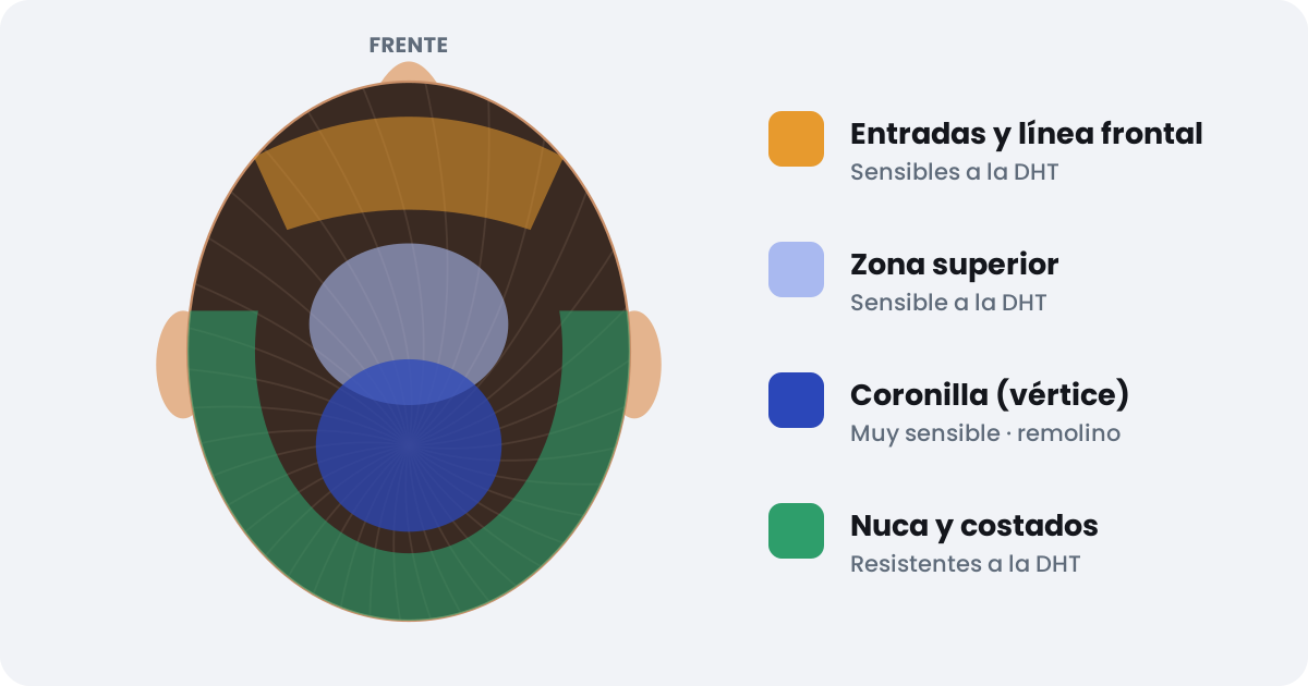 Zonas sensibles a la DHT